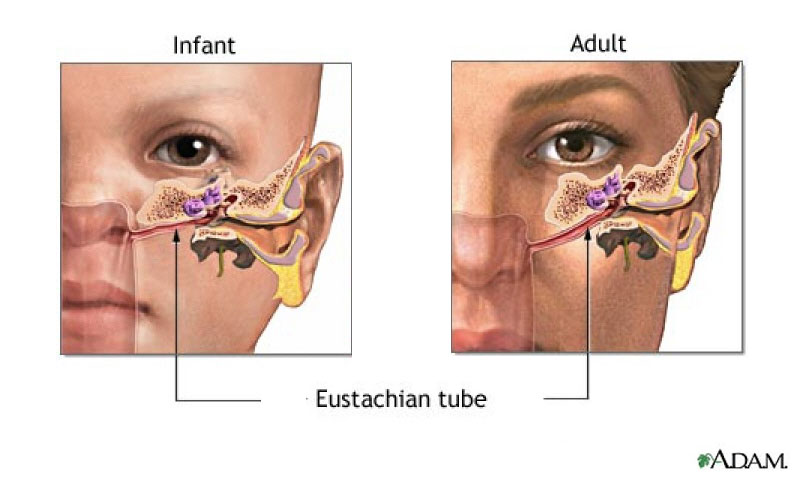surgery for ear tubes in adults surgery for ear tubes in adults