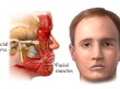 face damage Facial nerve Are you ready for this domination